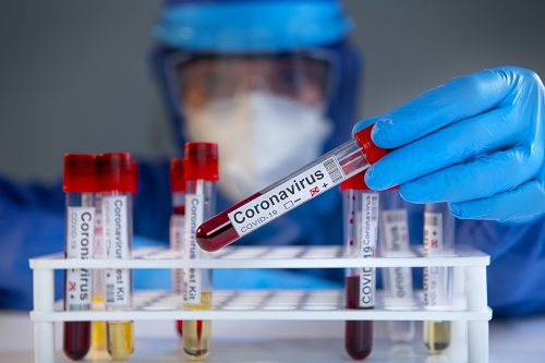 Doctor wearing highly protective suit and examining coronavirus covid 19 test tubes in laboratory